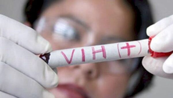 Fundación pide no exigir prueba del VIH para concurso de méritos
