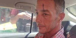 Habló el que le “jugó” un botellazo a Milei e hirió a un guardia: "Lo siento, estaba borracho"
