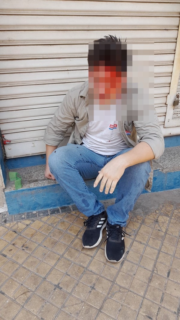 Le habrían roto el brazo a un manifestante detenido | 1000 Noticias