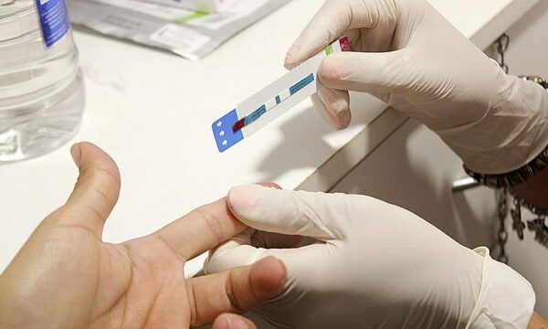 Ministerio de Justicia exige test de VIH para concurso laboral