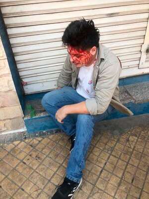 Fiscalía abre causa penal por brutal actuar policial contra manifestantes - Policiales - ABC Color
