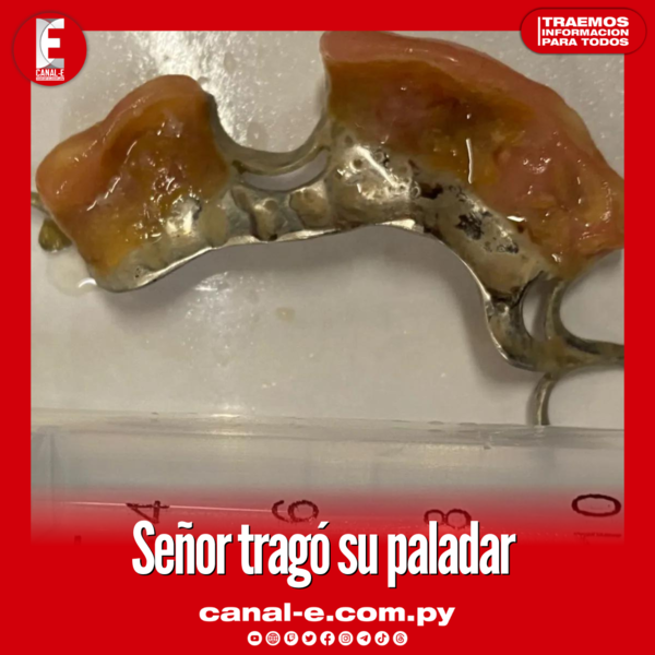 Señor tragó su paladar