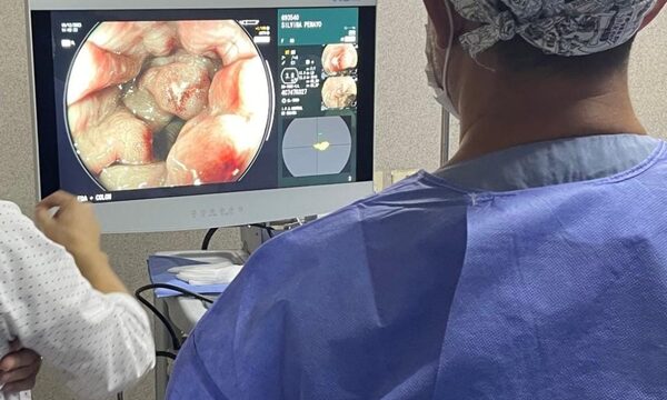 Uso de inteligencia artificial en colonoscopía permite eficacia en diagnóstico y tratamiento