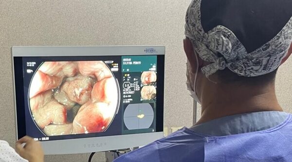 IPS incorpora la inteligencia artificial a la colonoscopía
