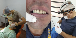 SONRISAS QUE TRANSFORMAN VIDAS! 150 PRÓTESIS DENTALES ENTREGADAS EN 2 DÍAS EN EL HRE - Itapúa Noticias
