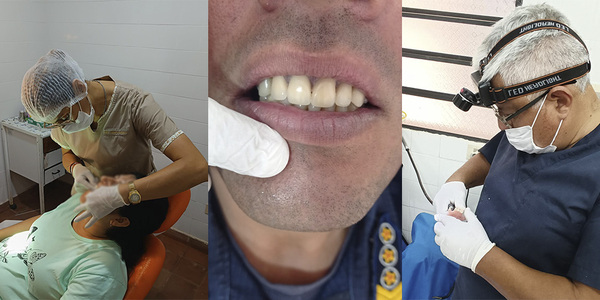 SONRISAS QUE TRANSFORMAN VIDAS! 150 PRÓTESIS DENTALES ENTREGADAS EN 2 DÍAS EN EL HRE - Itapúa Noticias