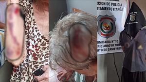 Violento hombre pasará la Navidad tras las rejas por agredir brutalmente a sus padres en Cambyretá