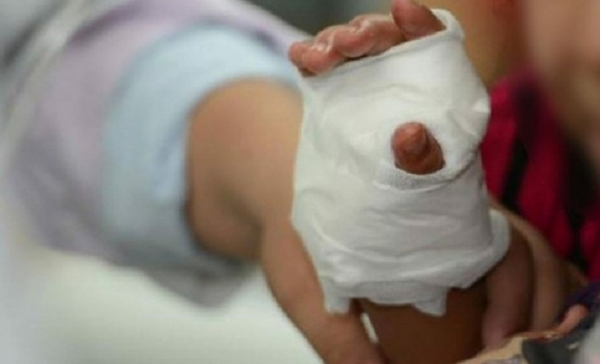 Un niño de un año y un joven de 19, lesionados por pirotecnia - Noticiero Paraguay