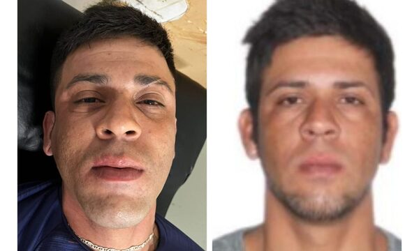 Hieren a delincuente durante enfrentamiento policial