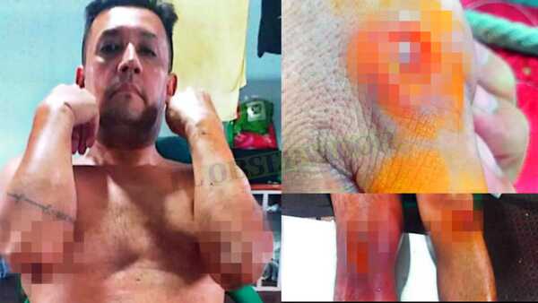 Denuncian caso de tortura durante intervención en la Penitenciaría de Tacumbú