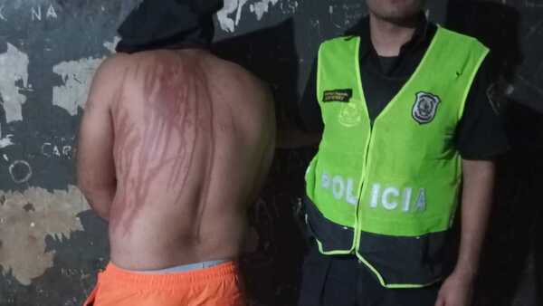 "Le tiré una lata de creolina para defenderme", dijo la embarazada