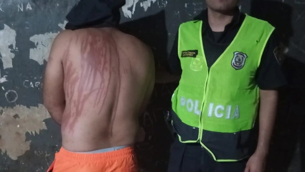 “Le tiré una lata de creolina para defenderme”, dijo la embarazada