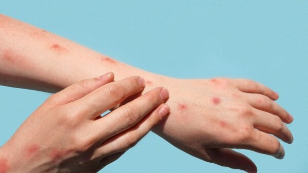 Niña y adolescente mueren por dengue