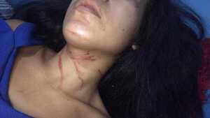 Mujer denuncia que intendente la golpeó brutalmente
