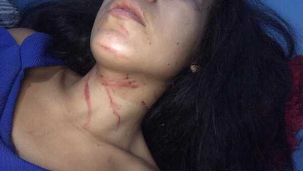 Mujer denuncia que intendente la golpeó brutalmente