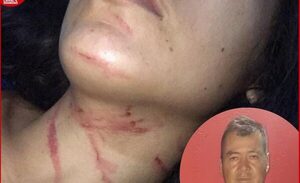 Una joven mujer denuncia que fue brutalmente golpeada por karai intendente