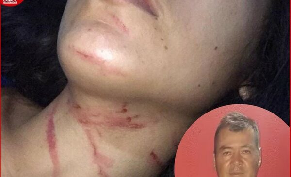 Una joven mujer denuncia que fue brutalmente golpeada por karai intendente