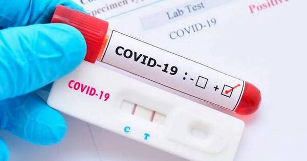 La Nación / Preocupa aumento de casos de covid