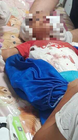 Bebé resultó herido con arma blanca durante gresca entre indígenas - Policiales - ABC Color