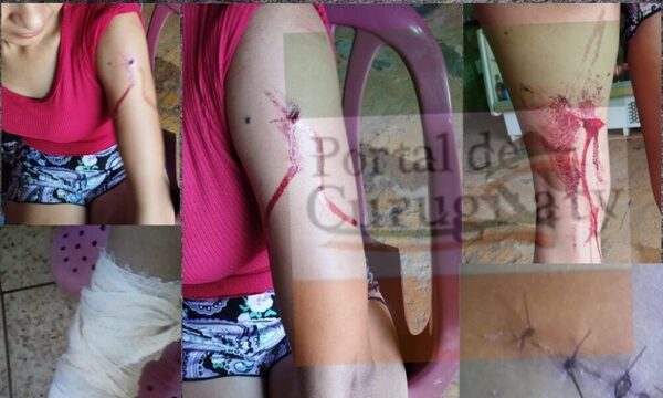 Doña denuncia que su pareja casi la mata a golpes