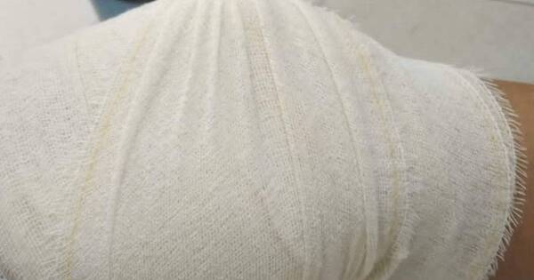 Diario HOY | Itapúa: mujer recibió un tiro mientras estaba sentada en su vereda
