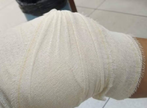 Mujer recibió un tiro mientras estaba sentada en su vereda - Noticiero Paraguay