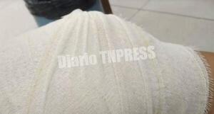 Mujer recibió un tiro mientras estaba sentada en su vereda – Diario TNPRESS