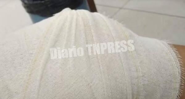 Mujer recibió un tiro mientras estaba sentada en su vereda – Diario TNPRESS