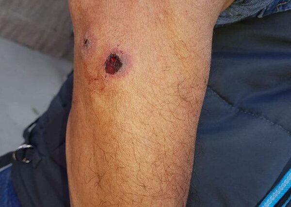 Guardia fue baleado por su colega durante una gresca – Diario TNPRESS