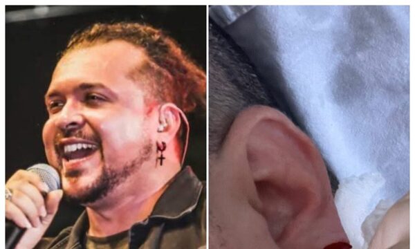 ¡Dani Meza se partió la oreja y tuvo que ingresar a cirugía!
