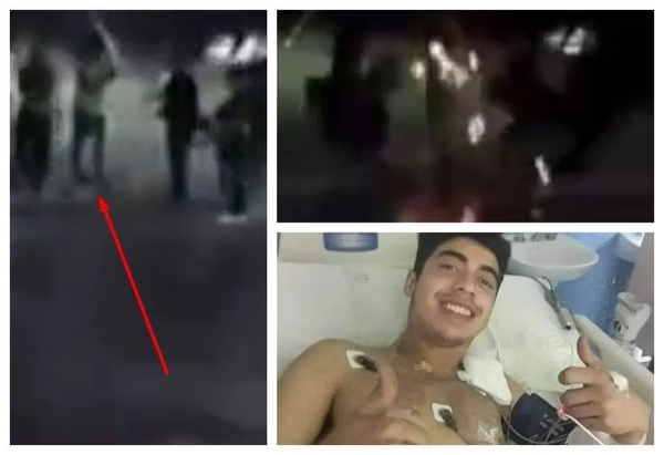 Joven sobrevive de milagro tras caerle un rayo - Noticiero Paraguay