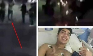Joven sobrevive tras caerle un rayo en Argentina – Prensa 5