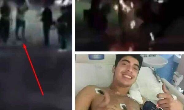 De milagro: joven sobrevivió al impacto de un rayo en Argentina - Portal Digital Cáritas Universidad Católica