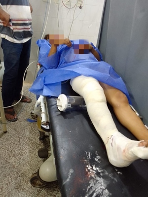Adolescente indígena de 17 años involucrado en accidente de tránsito requiere implante de platino