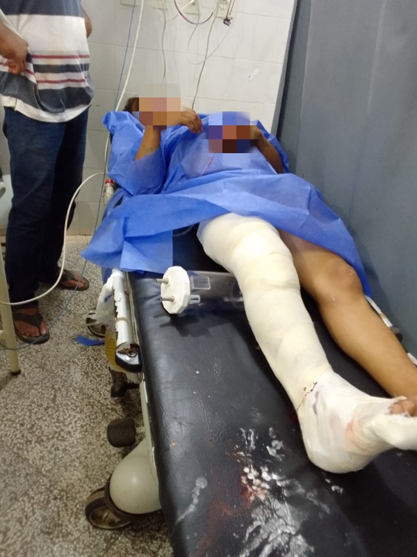 Adolescente indígena de 17 años involucrado en accidente de tránsito requiere implante de platino