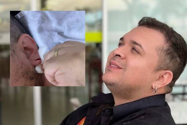 El cantante Dani Meza sufrió un insólito accidente