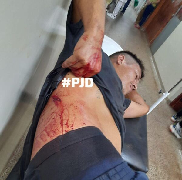 PJC: Pelea entre adictos dejó un herido por arma blanca en el barrio Mariscal Estigarribia