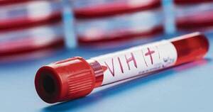 Diario HOY | Instan a realizar las pruebas de VIH e ITS, todas gratuitas y confidenciales