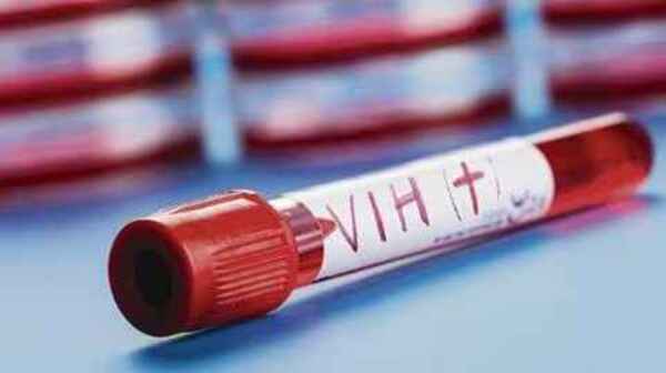 Instan a realizar las pruebas de VIH e ITS, todas gratuitas y confidenciales