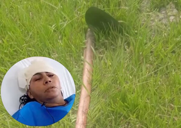AZADEÓ A SU PAREJA CON LA INTENCIÓN DE MARTARLA Y LUEGO SE SUICIDÓ
