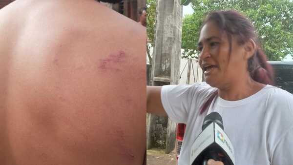 Madre denuncia brutal agresión de la Armada Naval a su hijo