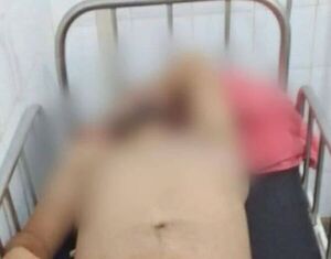 Mujer furiosa reventó los testículos de su pareja: pilló algo en el celular