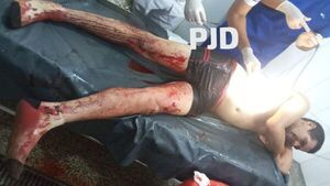PJC: Hieren con cuchillo a un hombre en San Juan Neuman