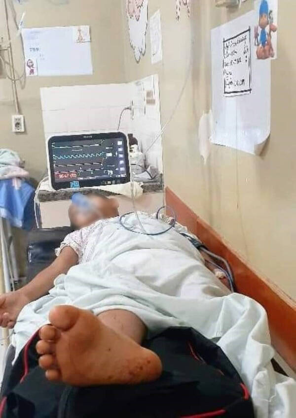 Chiquito de 11 años se metió a refrescarse a un río y vivió un vía crucis tras picadura