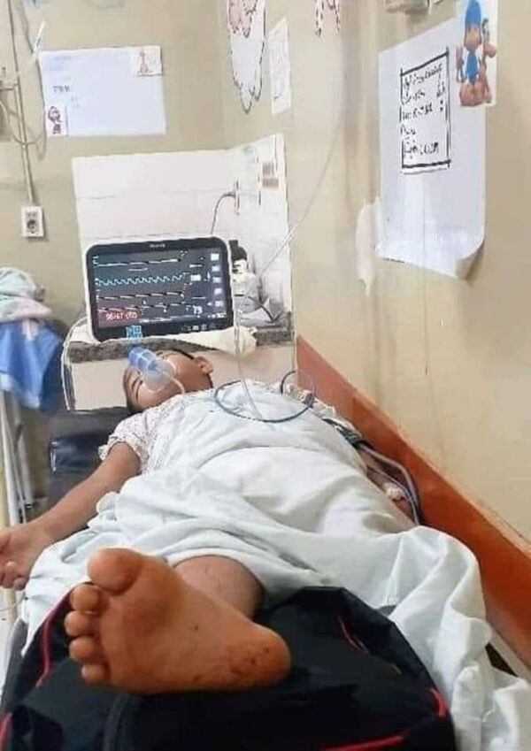 NIÑO DE 11 AÑOS FUE MORDIDO POR SERPIENTE CASCAVEL EN NARANJAL - La Voz del Norte