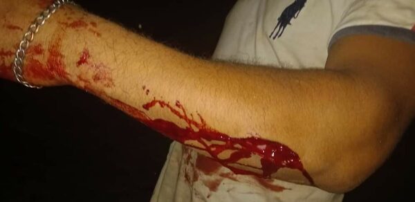 Vecino le atacó con machete y huyó