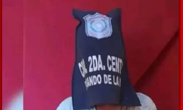 Hijo infeliz le arrancó el cuero cabelludo a su mamá tras lanzarla al piso