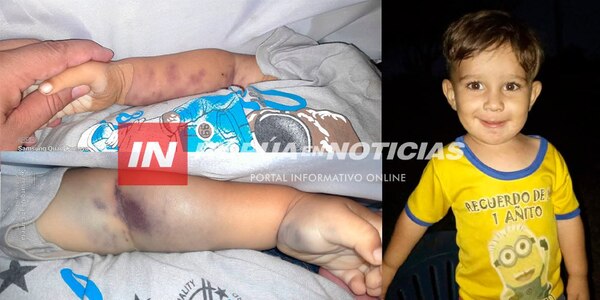 NIÑO DE DOS AÑOS FALLECIÓ EN ALTO VERÁ Y SU MADRE DENUNCIA MALA PRAXIS - Itapúa Noticias