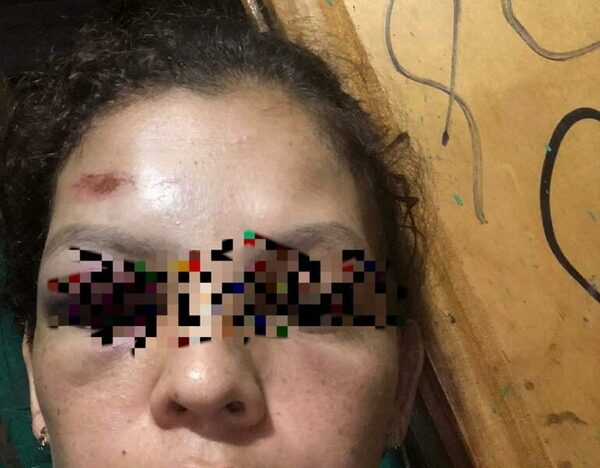 Yby Pyta: Joven denunció que casi la matan dos motoqueiros
