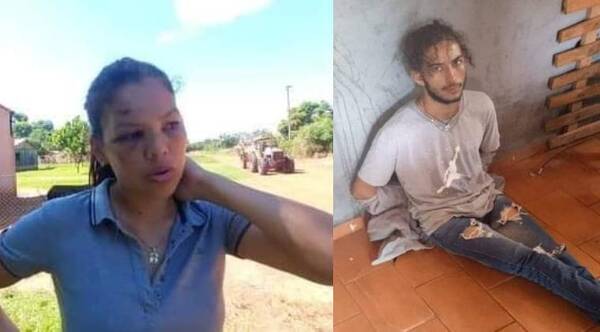 Joven sufre brutal golpiza y acusa a sus expatrones de contratar a ‘matones’ - Noticiero Paraguay